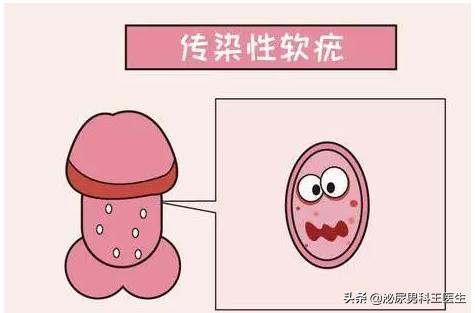 化脓性汗腺炎最新治疗