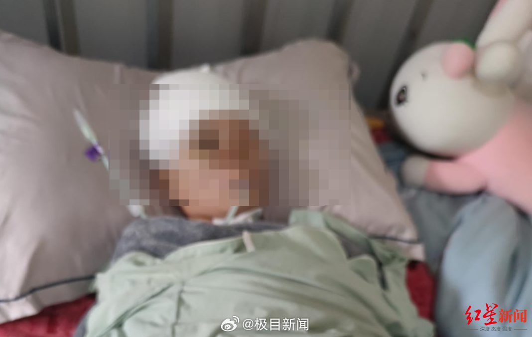 精准澳门平特一肖_戴鲨鱼夹摔倒重度昏迷女子被接回家