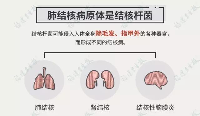 徐州肺结核事件最新进展