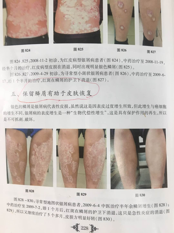 第1476页